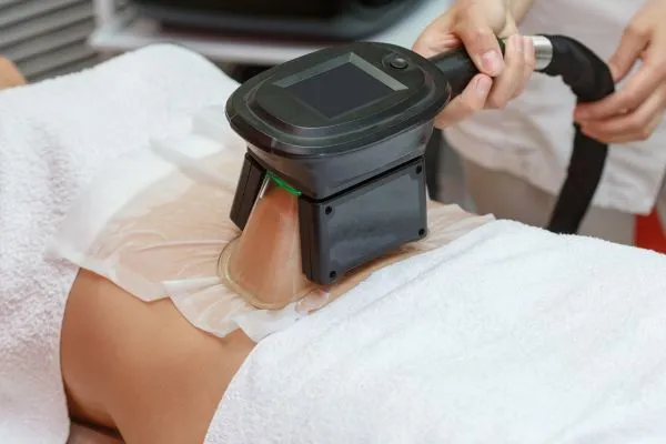 Image of person having fat freezing treatment to help weight gain Paisley