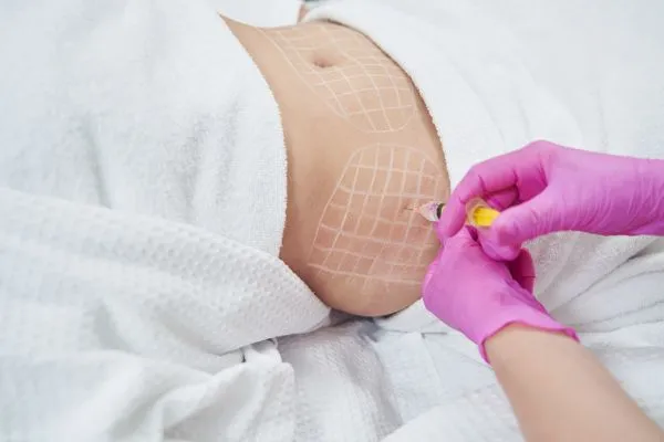 image of fat dissolving injections on love handles to help combat weight gain Paisley
