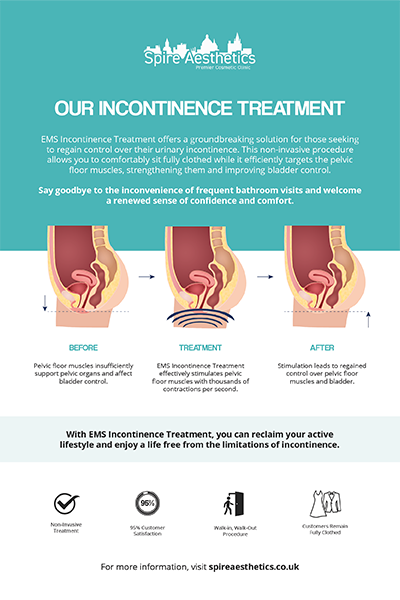 image to show how EMS treatment works for female urinary incontinence Paisley