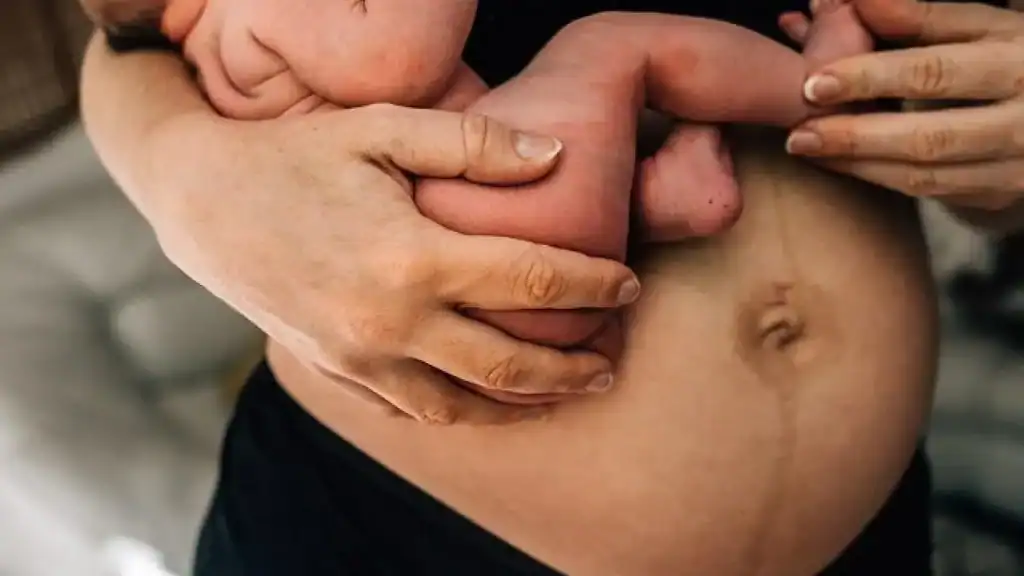 Why Is My Stomach Still Big After Pregnancy Paisley?